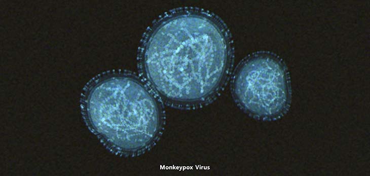 monkeypox virus structure
