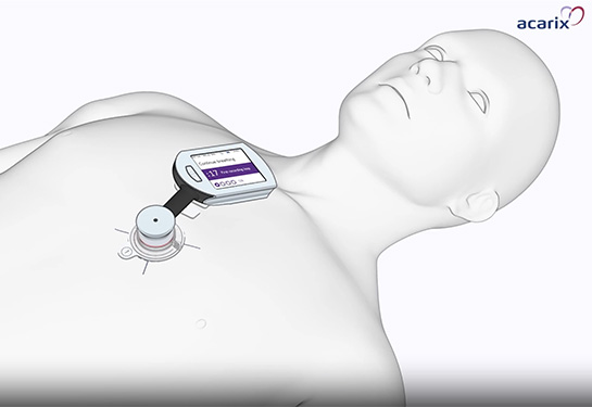 A rendering of a person laying on their back with a sensor resting on middle of chest and connected to a monitor