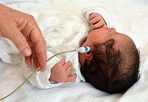 Newborn hearing screening.