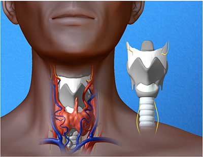 Graphic of larynx transplant &#169; UC Regents