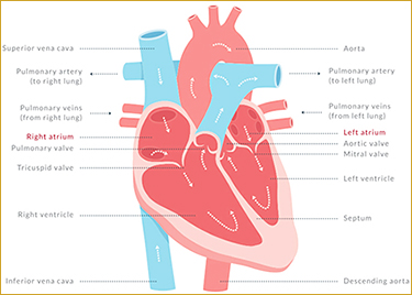 Graphic of human heart showing where AFib occurs
