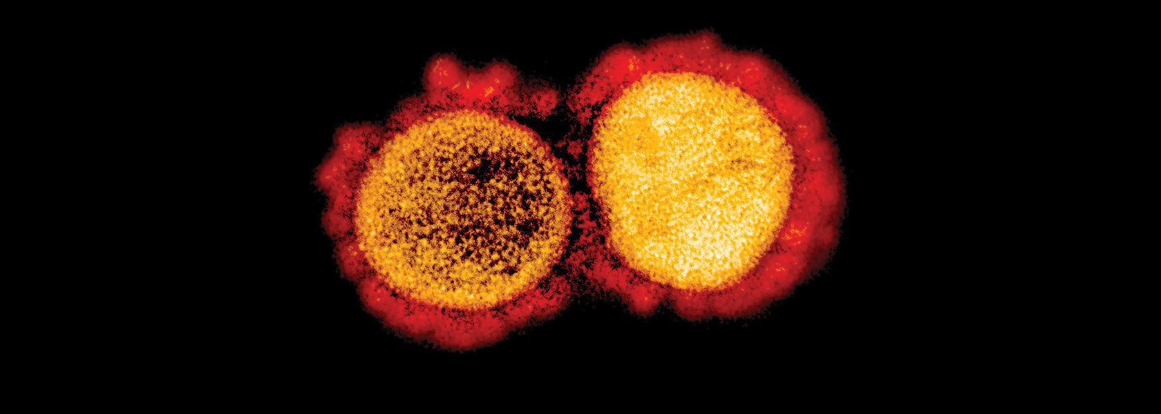 Image of a coronavirus virus strain