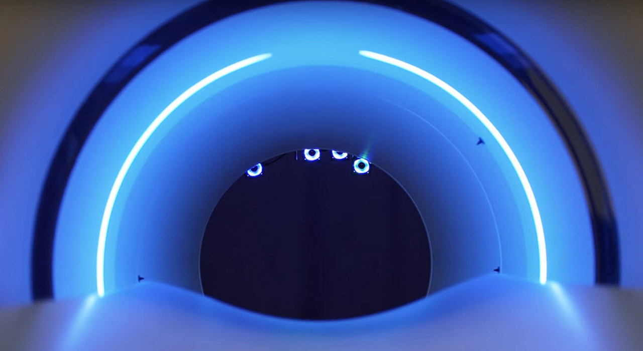 EXPLORER: The World's First Total-Body PET Scanner at UC Davis Health