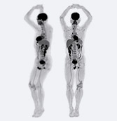 total body scanner images