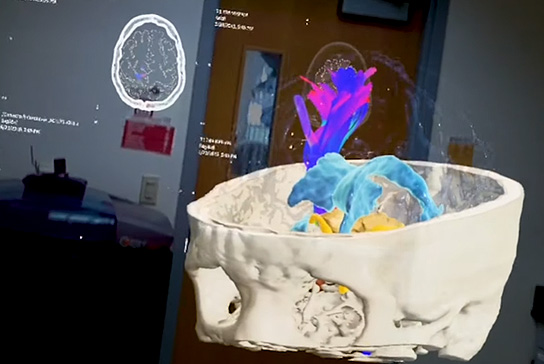 Doctors using 3D visualization before surgery.
