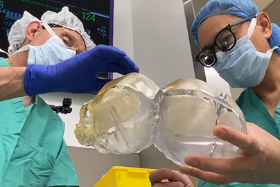 Two surgeons inspecting a 3D model of infant conjoined twins skulls.