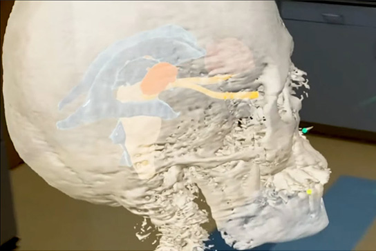 Projected 3D image of a skull.