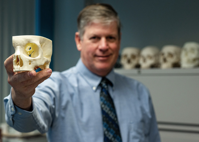 Professor E. Bradley Strong, M.D. holding a 3D printed portion of a skull.