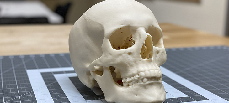 3D Printed skull
