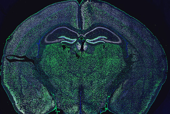 research image of neuronal accumulation of ribosomal reporter (green) in the brain of adult mice