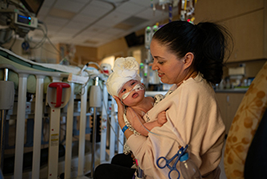 Liliya with baby Micaela, three days after separation surgery.
