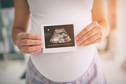 expecting mom holding ultrasound picture in front of belly