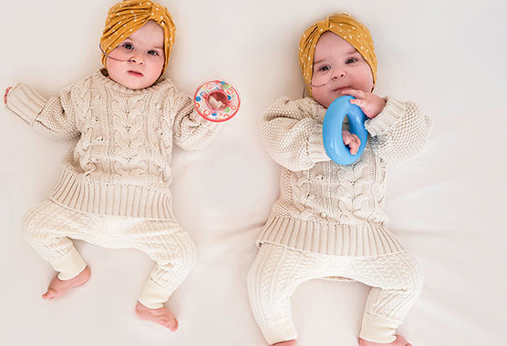Separated nine-month-old conjoined twins Abigail and Micaela Bachinskiy.