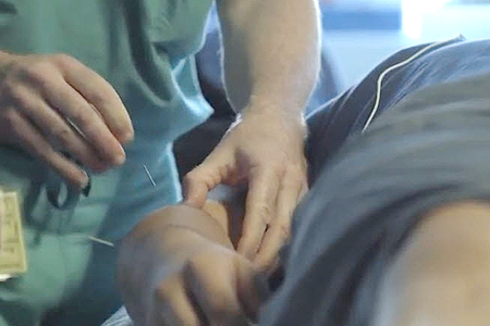 Dr. Lorimier performing acupuncture on a patient.
