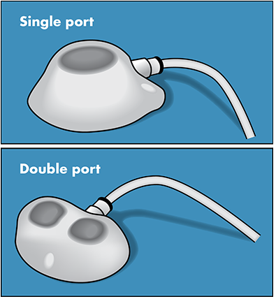 Single and double port catheter