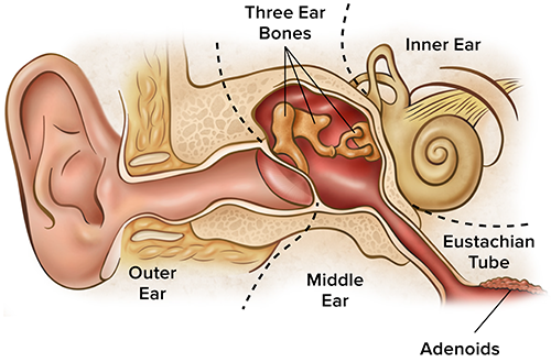 Ear tube placement illustration