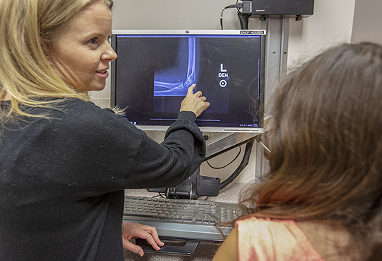 Female health care provider explaining x-ray of elbow to a patient.