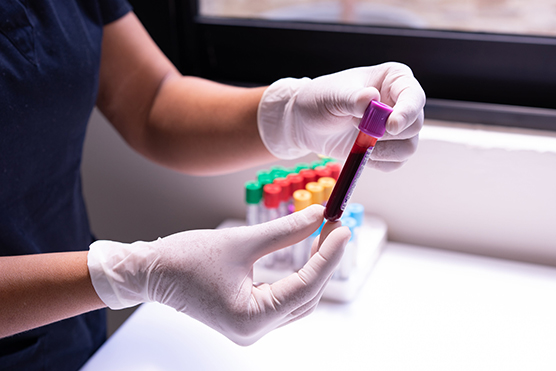 A hand holding a blood sample