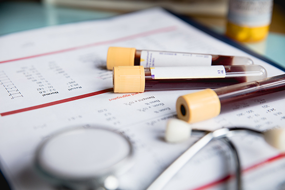 Vials of blood on a blood testing form.