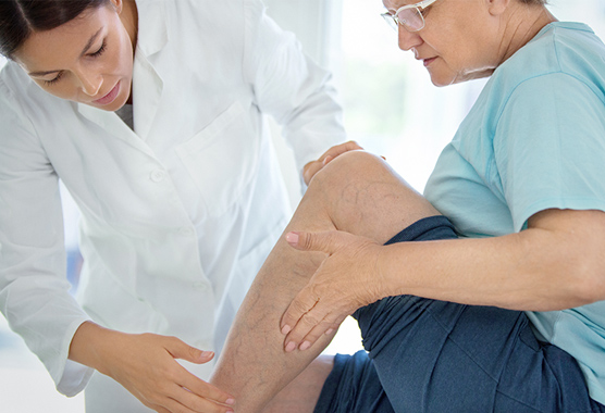 Health care provider and female patient examining the patient’s varicose veins on her leg.