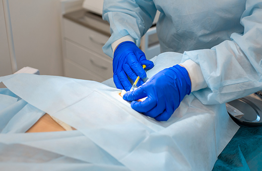 A doctor holds a syringe over a patients skin.
