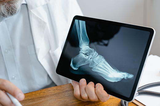 Health care provider holding an X-ray result of a foot