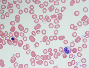 Nucleated red blood cell on the left and immature white blood cells on the right