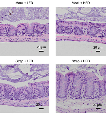 Image of changes in sections of the cecal mucosa based on combinations of low-fat diet (LFD), high-fat diet (HFD), with streptomycin (Strep) treatment 