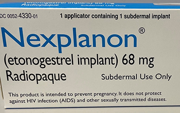 Nexplanon is a contraceptive implant that is inserted under the skin of the upper arm to provide birth control.