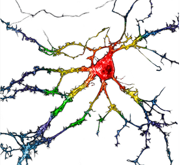 Dissociated neurons expressing psychLight. <em>Credit: Chunyang Dong, Calvin Ly and Joanne Ly at UC Davis.</em>