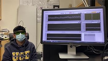 New technology developed at UC Davis may offer a less expensive way to assess how well the brain regulates blood flow. 