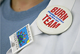 UC Davis Health provides excellence in burn care