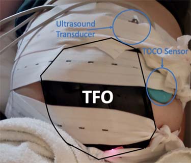 Device is shown on top of pregnant belly