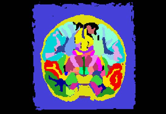 A single brain scan with each section of the brain highlighted a different color