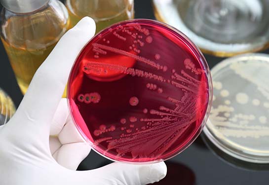 A gloved hand holds a petri with red agar showing growth of bacteria. 