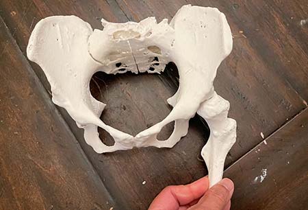 3D model of Malena's hip