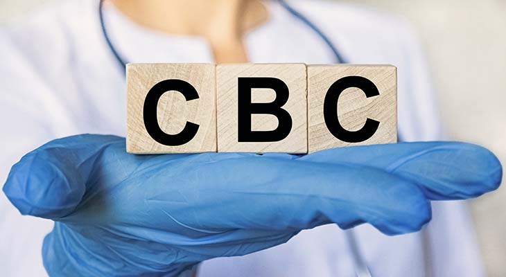 The letters CBC are written in black on wooden cube blocks in the hands in protective gloves of a doctor woman. Blurring doctor on background