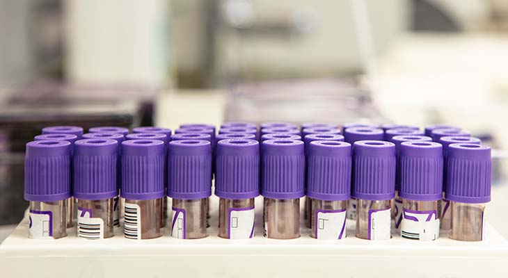Close up view of test tubes with purple caps in a row on a stand in a laboratory.