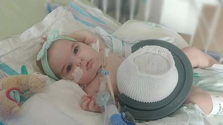 One-Of-A-Kind Brace Protects Baby Born With Organs Outside Her Body