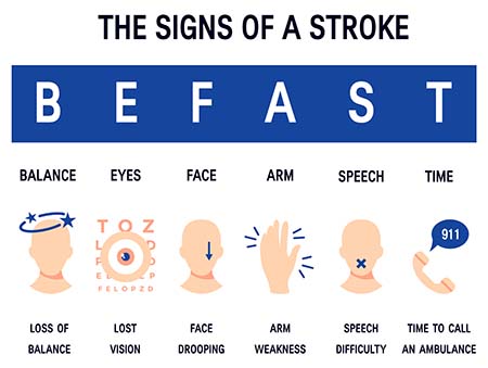 BE FAST infographic to help remember the symptoms of stroke, including loss of balance, lost vision, face drooping, arm weakness, and speech difficulty, which means time to call 911.