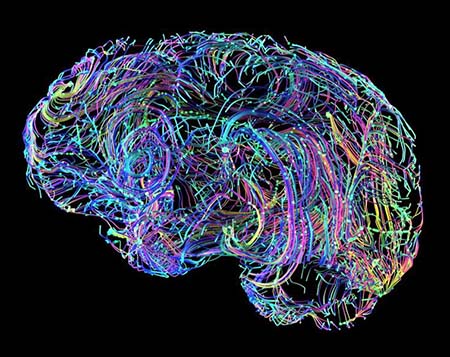 Multicolored lines create a stylized representation of the human brain against a black background. 