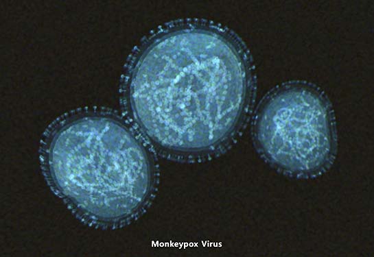 Monkeypox virus against a dark blue background