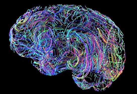 An artistic rendering of a brain, composed of colorful lines