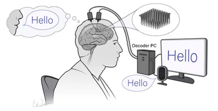 a person sitting before a computer monitor that says, “Hello” and is connected to a box which extends electrodes into the person’s brain