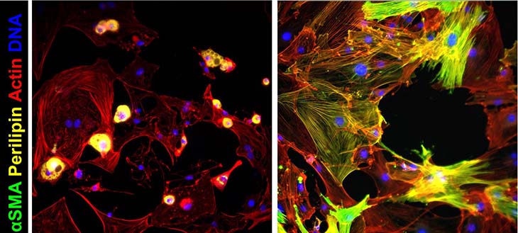 two colored figures showing smooth muscle alpha-actin (αSMA) and perilipin proteins in fat cells (left) and FAP (right) media