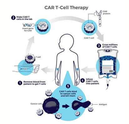 Process of the CAR T cell therapy