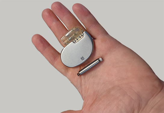 Retrievable leadless pacemaker
