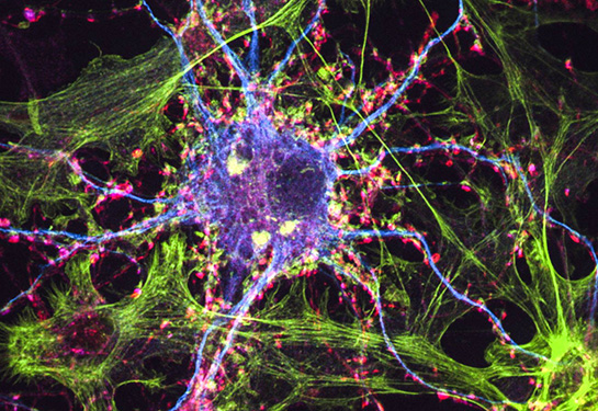 A close-up image of neurons, purple, pink and green, on a black background. 