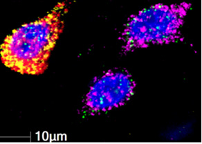 Image of inhibitory (GABA) cells in fuchsia and excitatory (vGLUT) cells in red and yellow on a black background