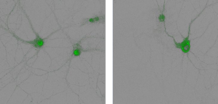 Two images show neurons in green against a grey background with a concentration of brighter green the center of the neuron. In the second image, the area with the brighter green is larger and fills more of the neuron. 